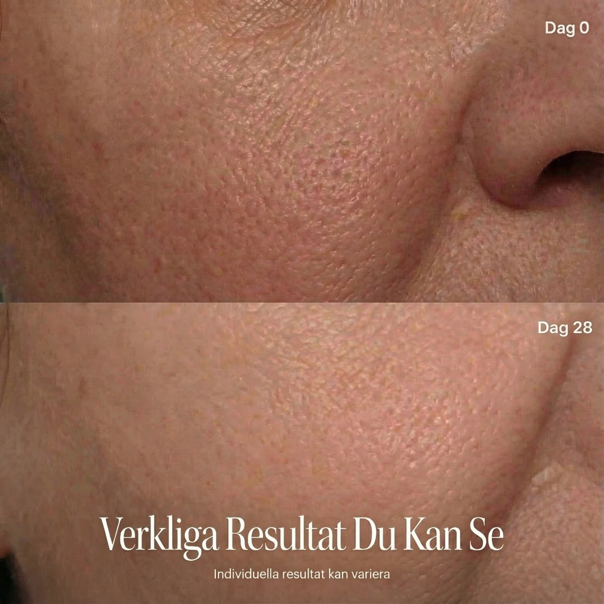 BamGlow LED Therapy Face Mask